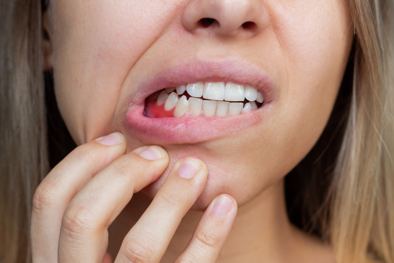 Recognizing Early Symptoms of Gum Disease