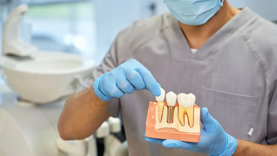 How Dental Implants Can Change Daily Life in Parma