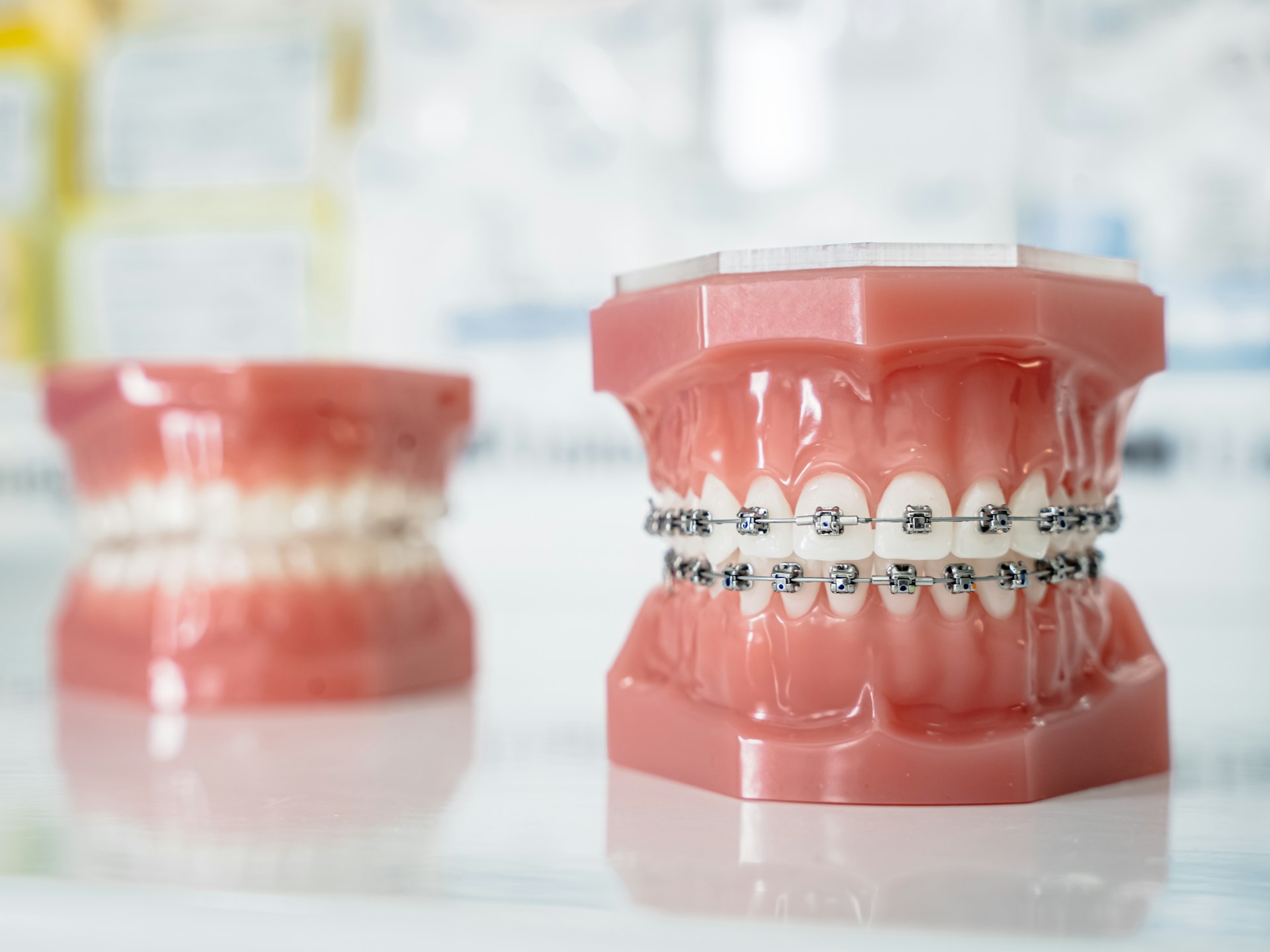 Top Tips for Finding an Orthodontist in Parma Ohio