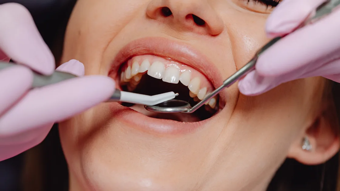 Spring Smile Refresh: Dental Cleanings in Parma