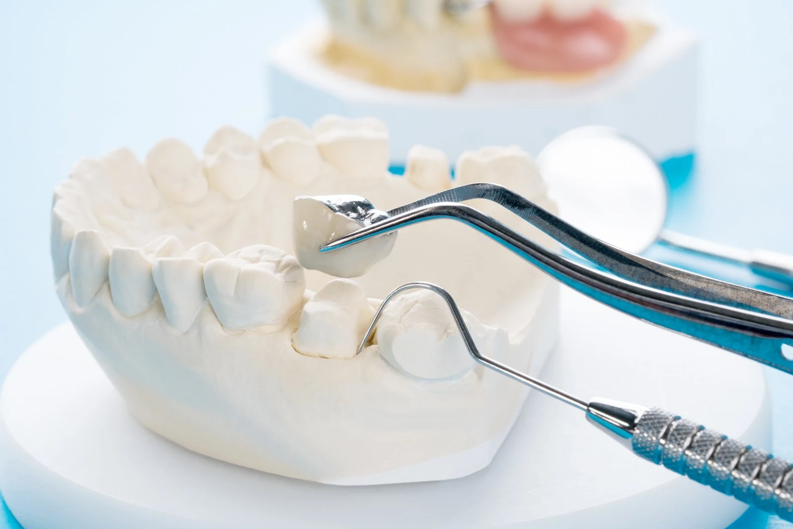 dental crowns & bridges