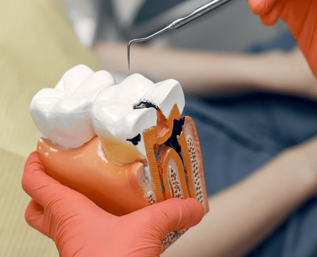 How We Treat Gingivitis