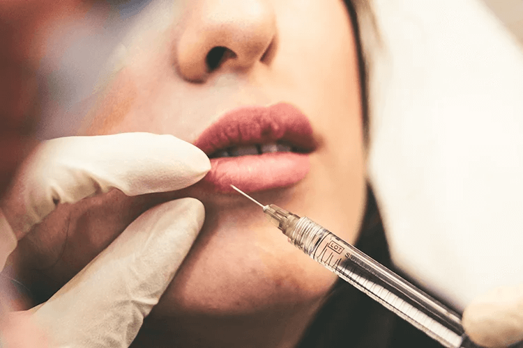 parma ohio dermal fillers