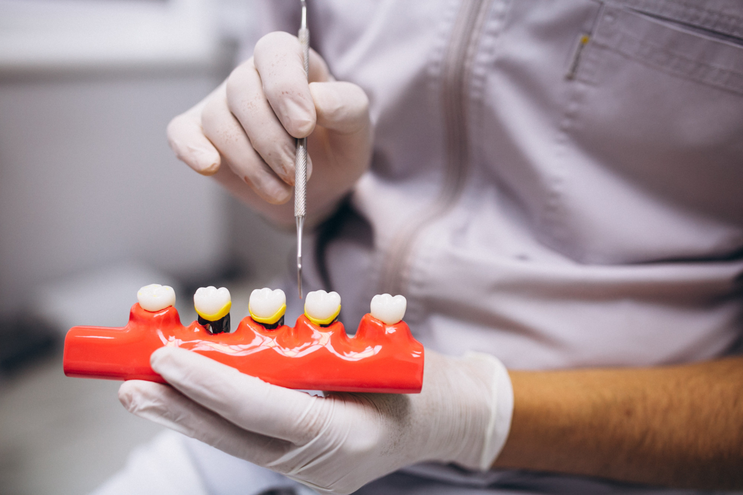 Tooth Repair