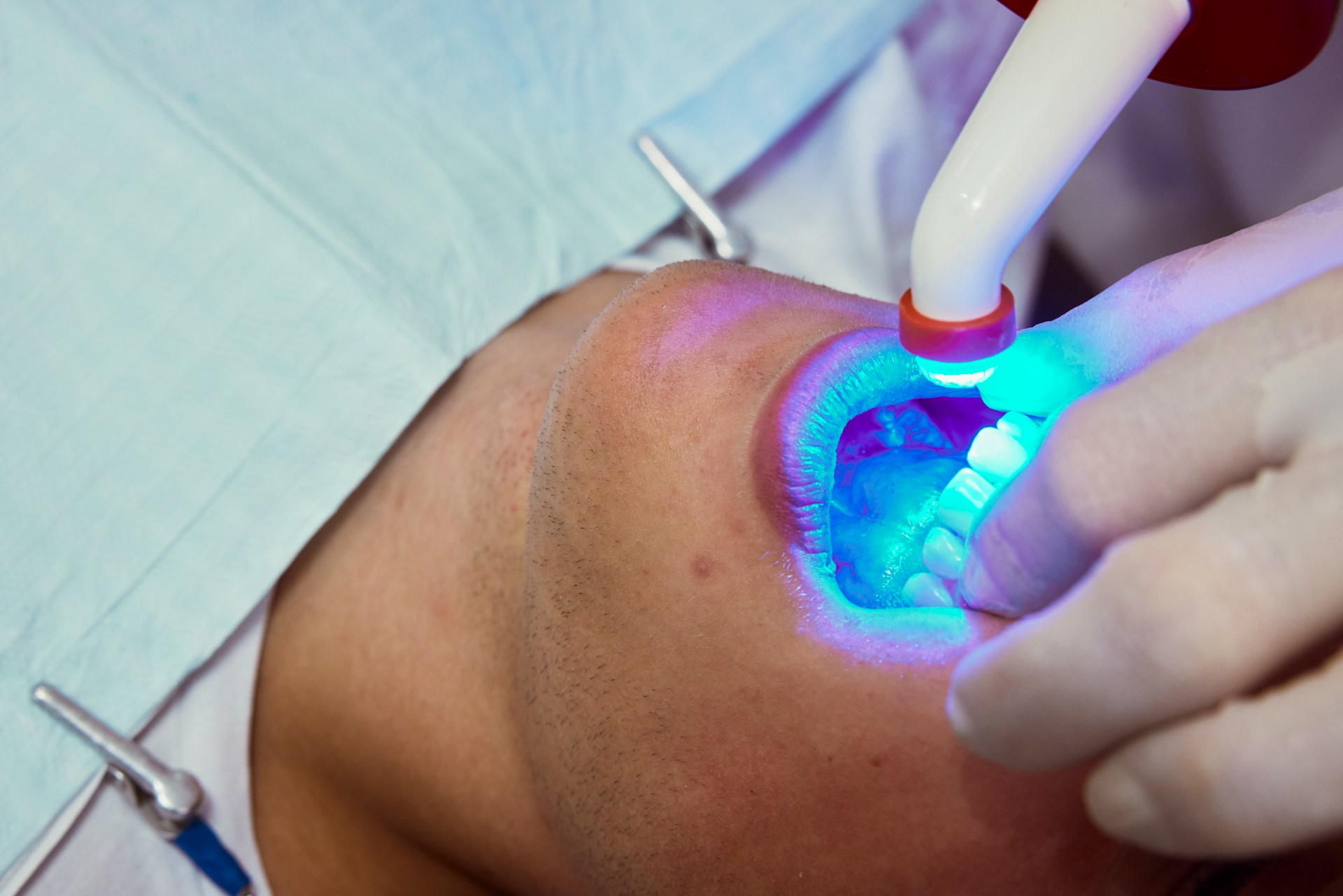Teeth Whitening