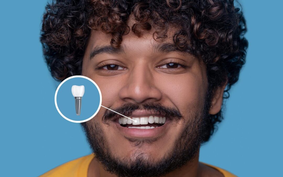 What a Dental Implant Crown Is and How It Actually Works