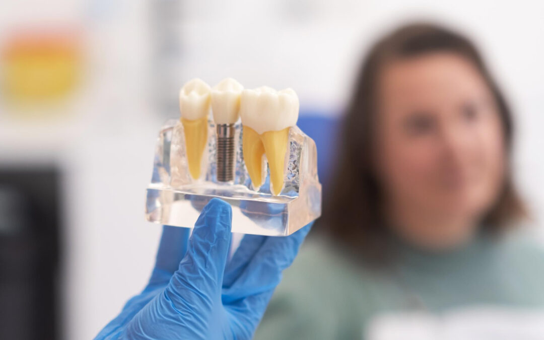 Step-by-Step Overview of Dental Implant Services for New Patients