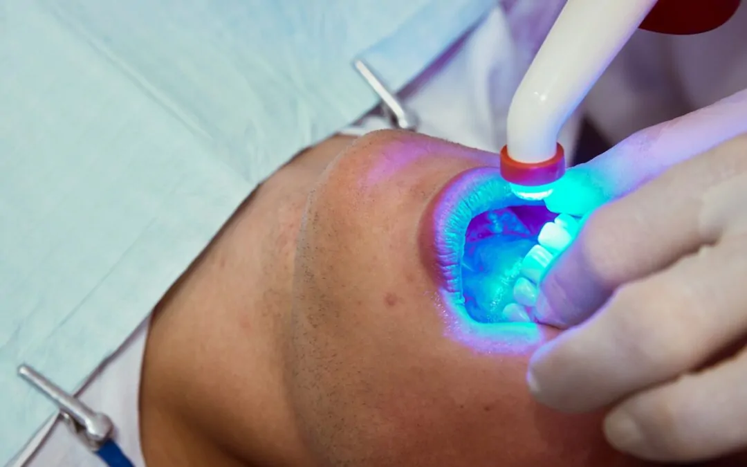 Will Professional Teeth Whitening Work for My Stained Teeth